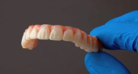 Dental component 3D printed using Formlab Dental's Premium Teeth Resin. Photo via Formlabs.