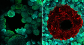 The original SWIFT method (left) printed hollow channels through living OBBs (green), but had no structure to contain fluid as it flowed through. Co-SWIFT (right) creates a cell-laden vessel (red) surrounding the channel, which isolates blood flow from the tissue and improves their viability. Image via Wyss Institute at Harvard University.