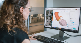 A woman looking at a computer screen showing the anatomical overview of an aortic root on SurgiCase software. Photo via Materialise.